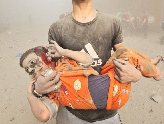Gaza death toll surges to 40,819 martyrs