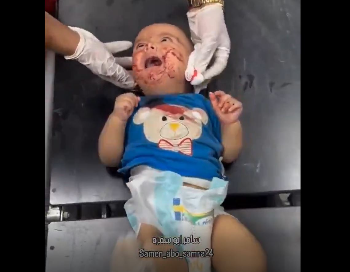 Video: No child deserves this, "the innocent Gaza"