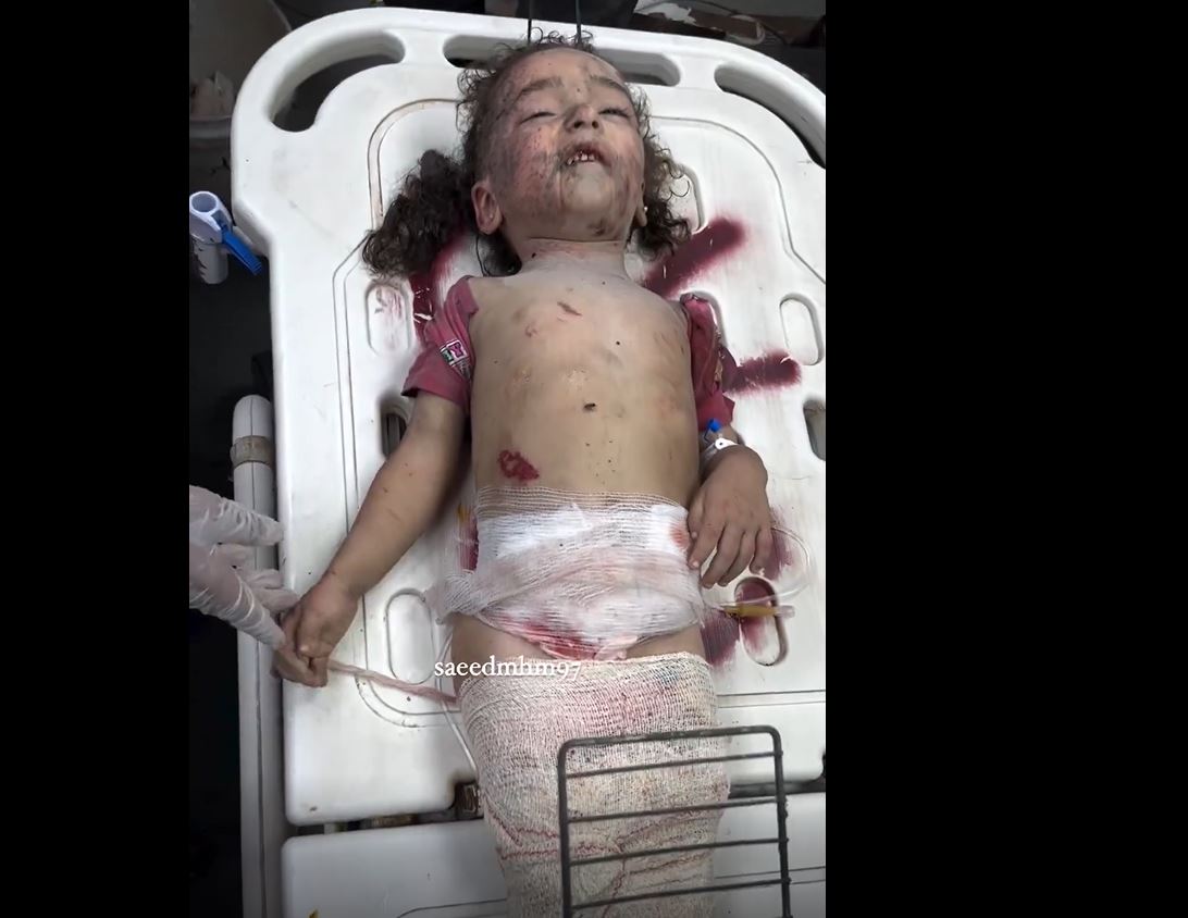 Video: Two little Palestinian sisters sustained critical injuries due to an Israeli airstrike on Central Gaza 