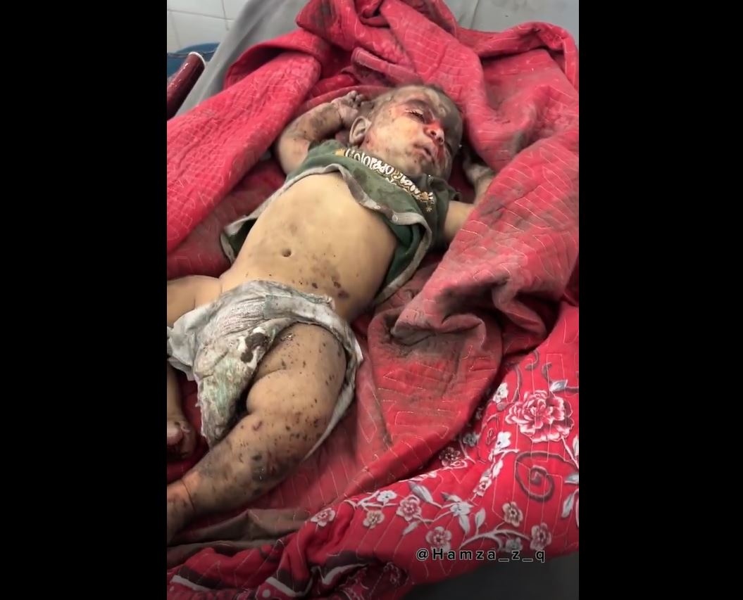 Sensitive Video: Two children killed, others injured in an Israeli airstrike targeting east of Gaza 