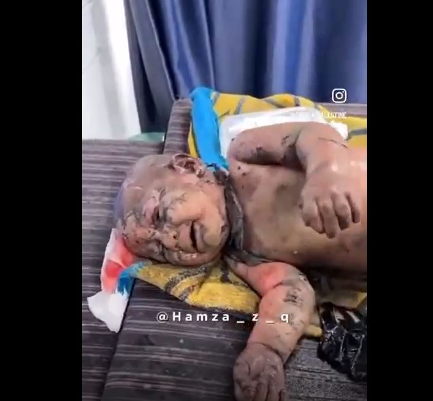 Video: Gaza children in suffering and torment