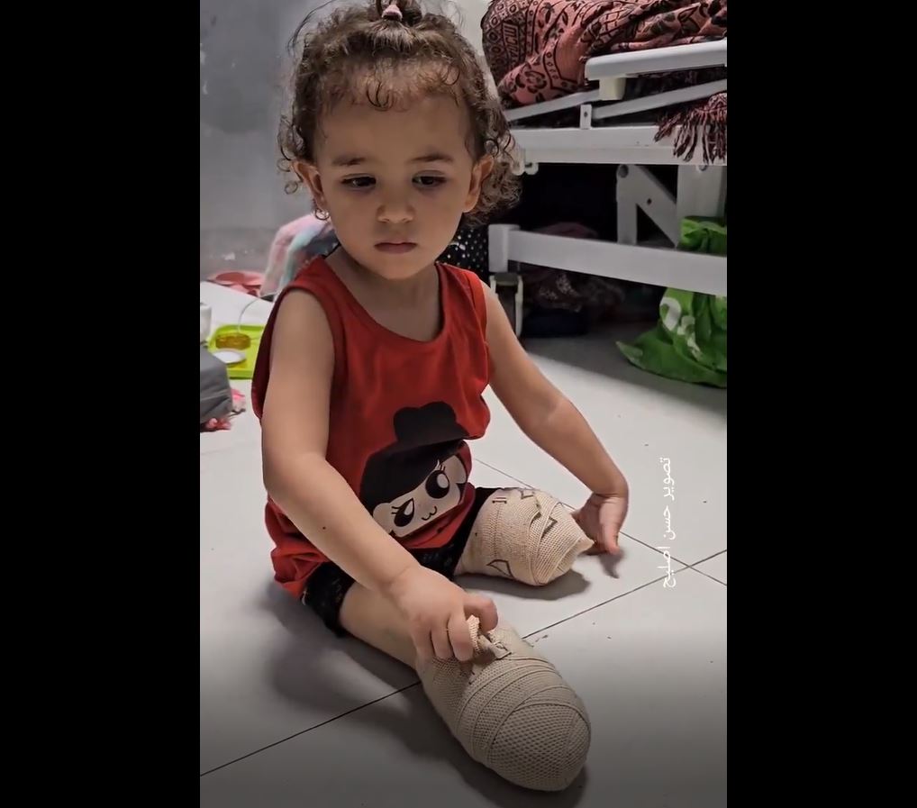 Video: 7-year-old Palestinian girl lost both her legs in an Israeli airstrike in Nuseirat, central Gaza