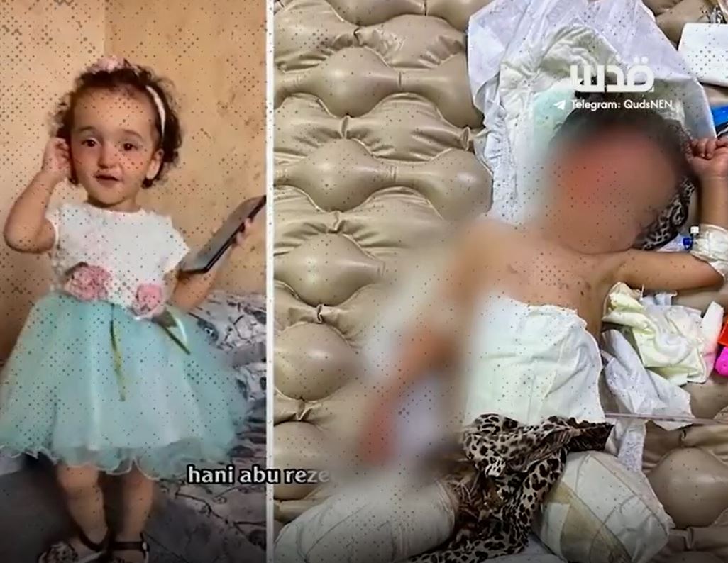 Video: Fate of two Palestinian little sisters from Gaza after vaccinated against polio