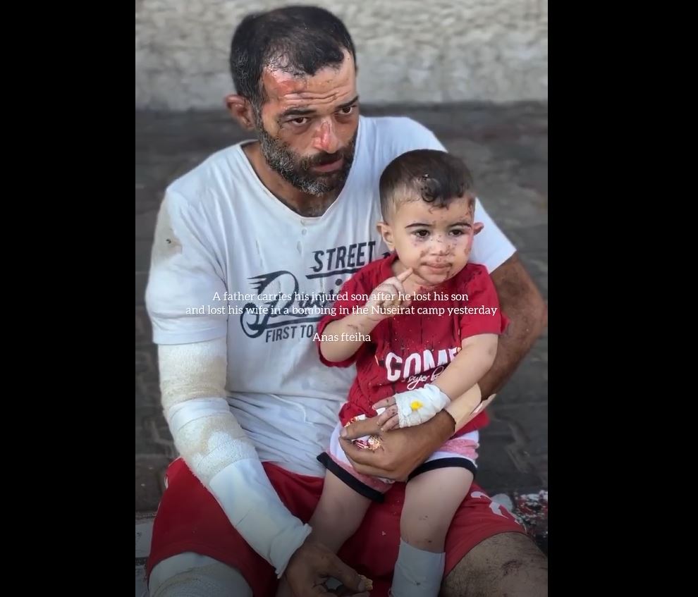 Video: A Palestinian father along his child injured in Israeli airstrike in Al Nuseirat, central Gaza