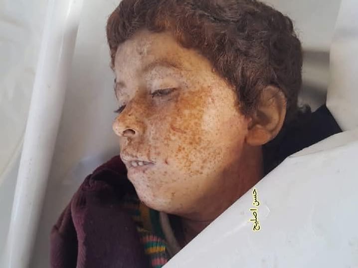 Three martyrs, four injuries reported in Rafah due to Israeli criminal forces shooting and explosions of ordnance