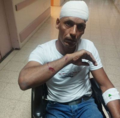 Israeli colonizers injure Palestinian near Jericho