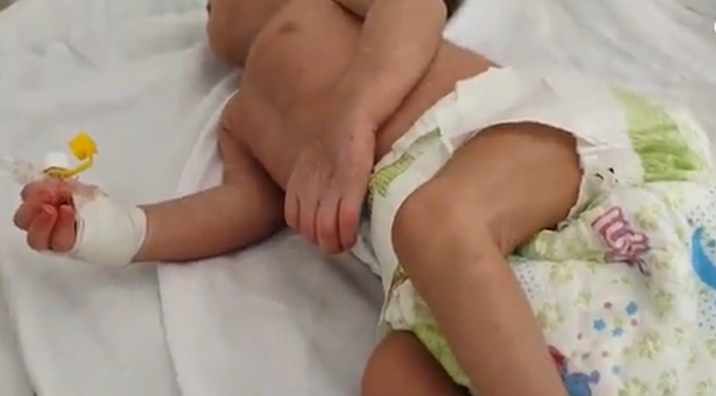 ویدیو | افزایش سوء تغذیه در اطفال بامیان افغانستان