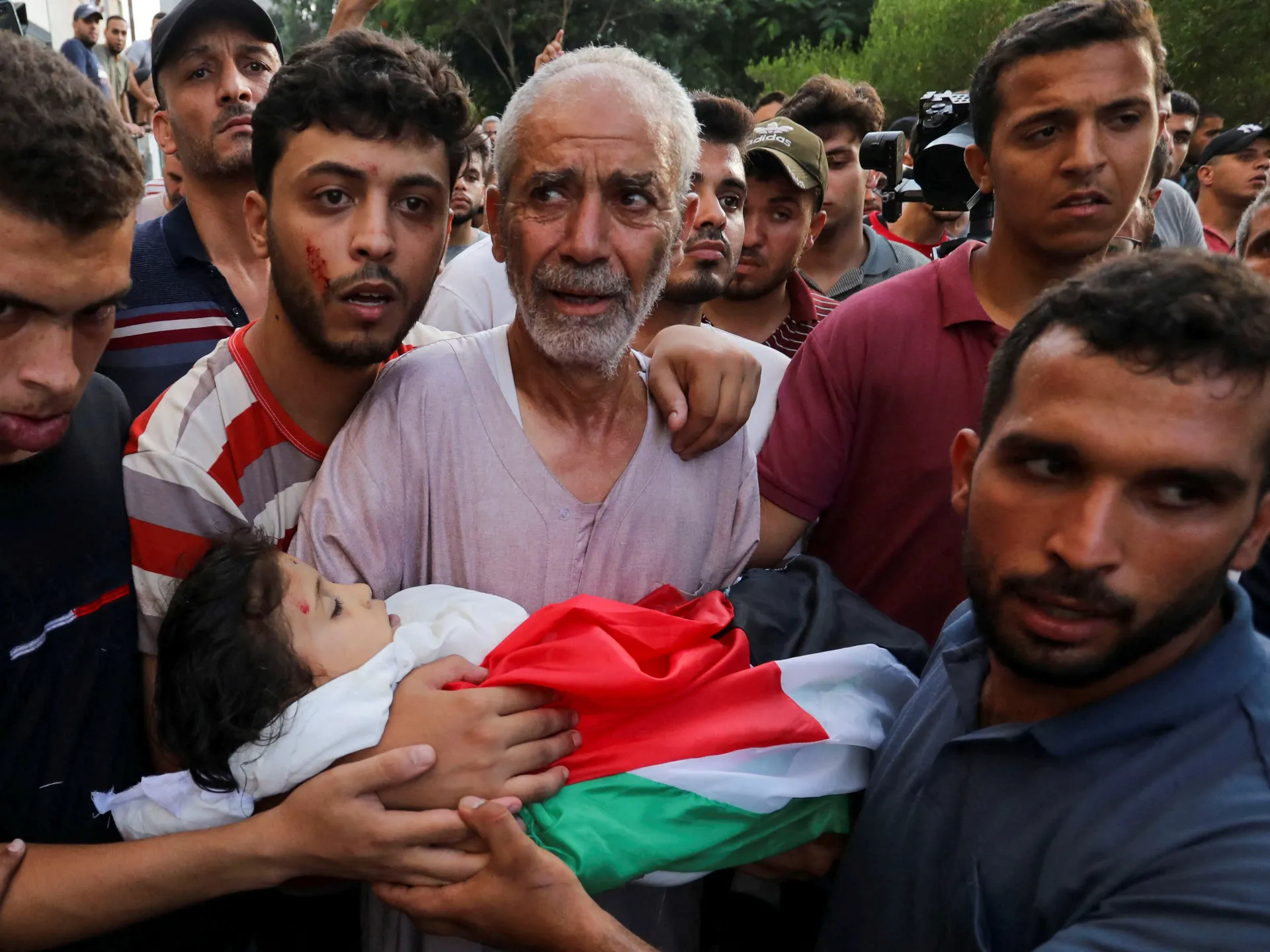فيديو | إسرائيل تتعمد استهداف أطفال فلسطين