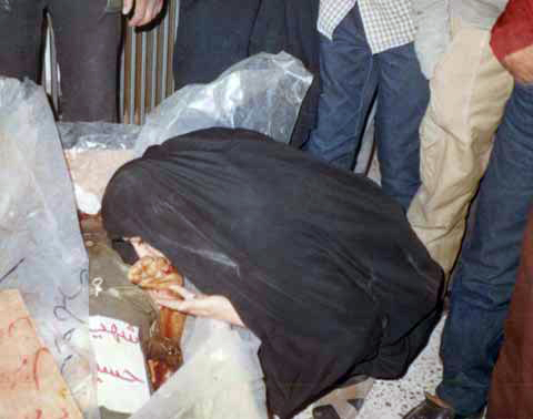 عکس/ آخرین بوسه یک خواهر