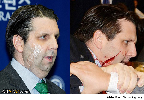 گزارش تصویری/ ترخیص سفیر مضروب آمریکا از بیمارستان سئول