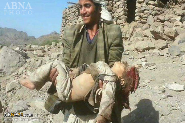شهادت زنان و کودکان یمنی در حمله جنگنده‌های سعودی + عکس