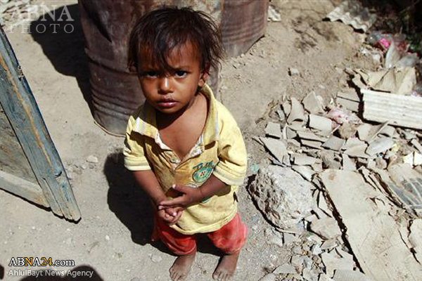 کشته و زخمی شدن روزانه ۶ کودک یمنی در حملات عربستان
