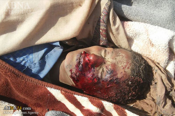 ۱۰ کشته و زخمی درپی حمله جنگنده‌های سعودی به آمبولانس مجروحان یمنی + عکس