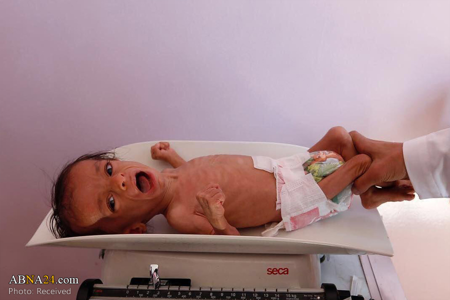 کارنامه سیاه رژیم کودک کُش عربستان: قتل ۲۳ هزار نوزاد یمنی در سال ۲۰۱۶