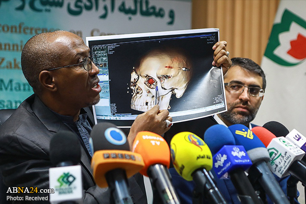 پزشک شیخ زاکزاکی: زنده ماندن شیخ معجزه است