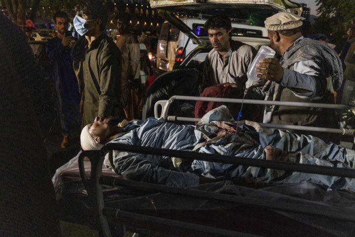  تلفات انفجار‌های کابل به ۱۰۳ نفر رسید