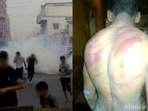 اعتقال 6 مواطنين و4 أطفال وأمرأة وعمليات تعذيب واقتحام 9 منازل بينهم رجل دين