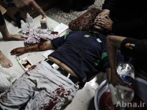 "العربية لمعلومات حقوق الإنسان" تستنكر استخدام قوات الأمن البحرينية للقوة المفرطة مع المتظاهرين