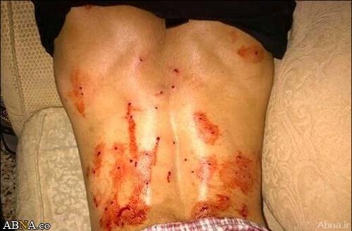 بحرین/ تصویری رپورٹ: شیعہ ہونے کے جرم میں، خون سے آ غشتہ جسم