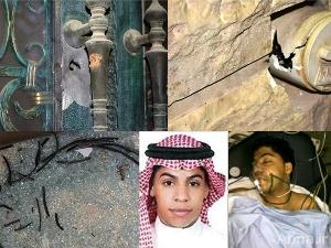بالصور / السلطات السعودية تعتقل المواطن «آل سريح» بعد إصابات بليغة بالرصاص الحي