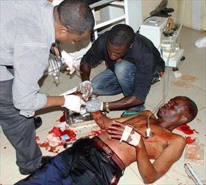 Bomu lalipoka kanisani jijini Arusha