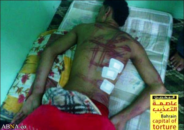 Image / Bahraini Revolutionists Tortured +18