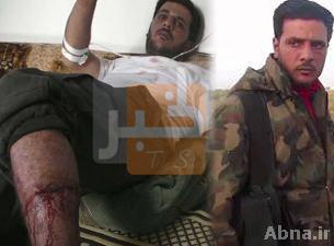 إصابة "أبو صقار" آكل قلب الجندي السوري بجروح