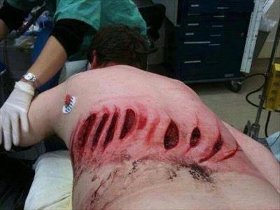 Image / Injuries of A Turkey Protesters Victims +18
