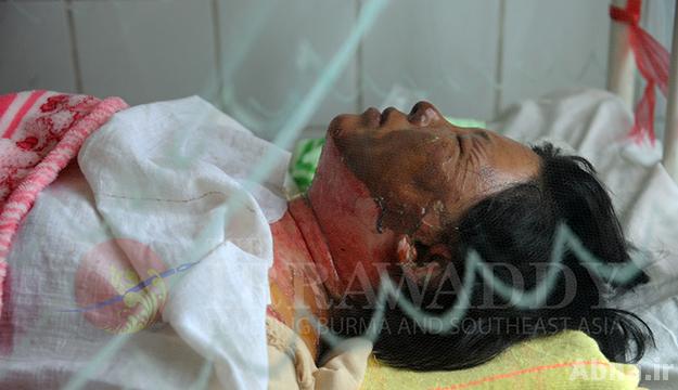 ပဋိပကၡအလြန္ လားရႈိး