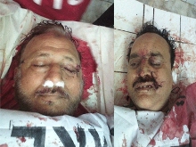 Two Shiite Muslims Including a Town Municipal Officer Shot Martyred in Karachi