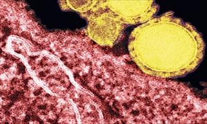 Yeni salgın: MERS virüsü