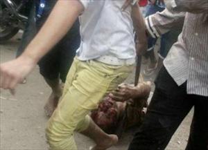 Al Azhar Scholar: "Shia Killing in Egypt Is Political Crime"