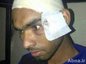 "مركز البحرين لحقوق الانسان" ينشر صورا تثبت تعذيب متهم بـ "14 فبراير"