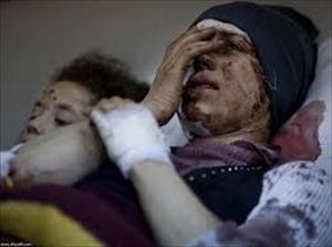 حلب کے مضافات میں عام شہریوں کا قتل عام