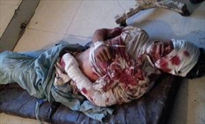 Pakistan'da Şia Katliamı: 57 Şehit, 167 yaralı / Foto