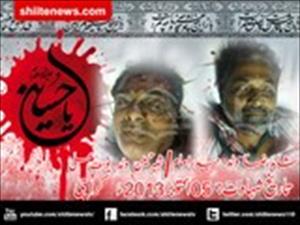 ناظم آباد :تکفیری وہابی دہشتگردوں کی فائرنگ سے 2شیعہ شہید