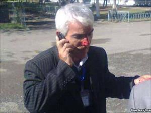 Seçki ərəfəsində seçki müşahidəçisi döyüldü + Foto