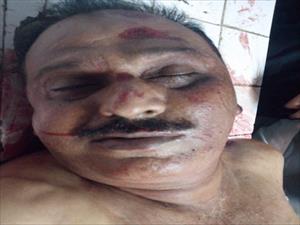 Shia Police Officer shot martyred in a Yazidi terrorist attack in Karachi