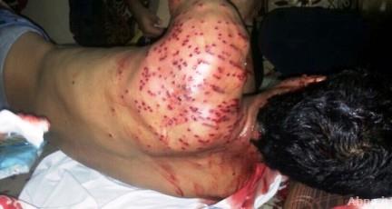 Official violence causes severe injuries among mourners in Bahrain