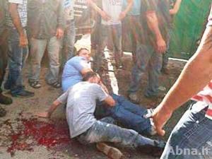 بالصور / مسلحون يعترضون حافلة تقل شباناً من "جبل محسن" ويطلقون النار على 6 من ركابها