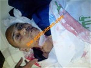 حیدرآباد :تکفیری دیوبندی دہشتگردوں کی فائرنگ سے شیعہ سیدداختر حسین زیدی شہید