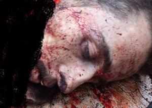 Şam'da Bu Sabah İntihar Saldırısını Gerçekleştiren Teröristen Geriye Kalan / Foto (18+)