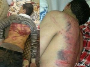 بالصور / اختطاف شاب بحريني وتعذيبه ست ساعات ثم رميه فجراً في مقبرة
