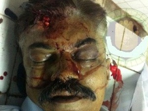 دہشتگردوں کی فائرنگ سے سید اقبال جعفری شہید
