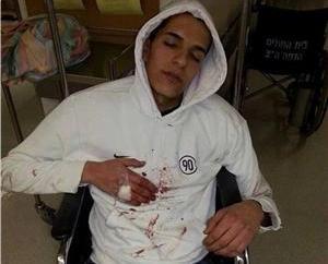 Jewish settlers stab Jerusalemite youth