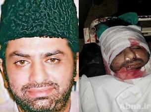 استشهاد رجل دين شيعي في هجوم ارهابي في باكستان + صور