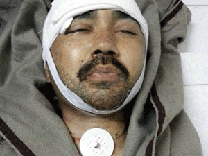 کوئٹہ میں کچھ روز قبل تکفیری دہشت گردوں کی فائرنگ سے زخمی ہونے والے چوکیدار شہید