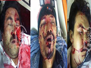 کراچی،گلشن مسکن چورنگی پردہشت گردوں کی فائرنگ سے 3 افراد شہید، 5 افراد زخمی