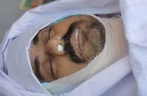 Takfiri terrorists killed a Shiite doctor in Karachi - Pakistan