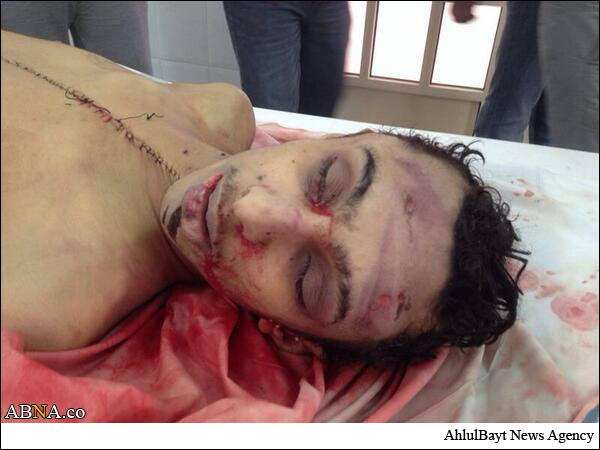 Les forces d'Al-Khalifa étaient martyr le jeunes  de manifestants chiites + images (+18)